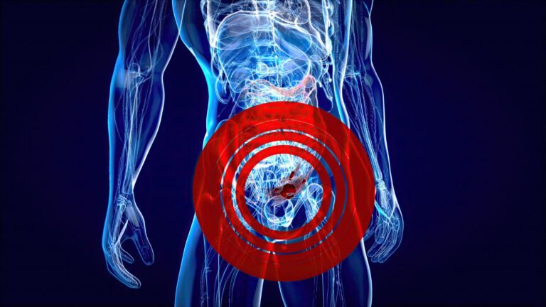 Cáncer colorrectal, una enfermedad silenciosa que exige atención